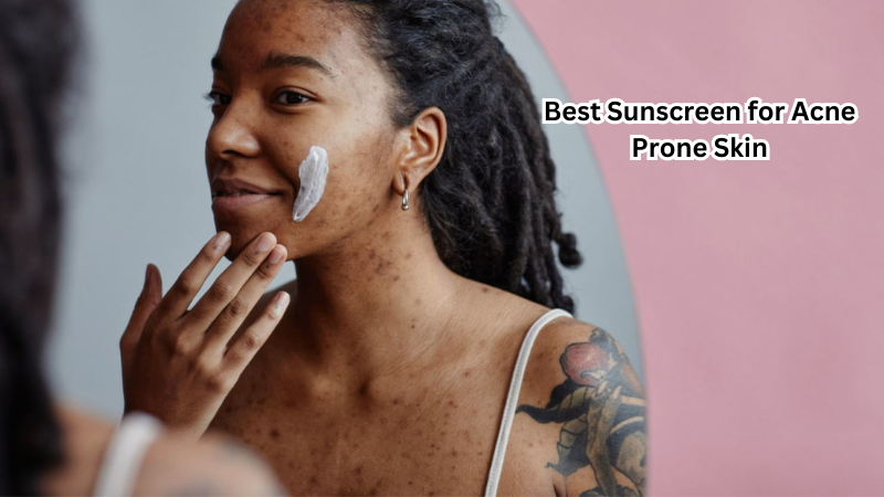 Glowing and Protected: Best Sunscreen for Acne Prone Skin